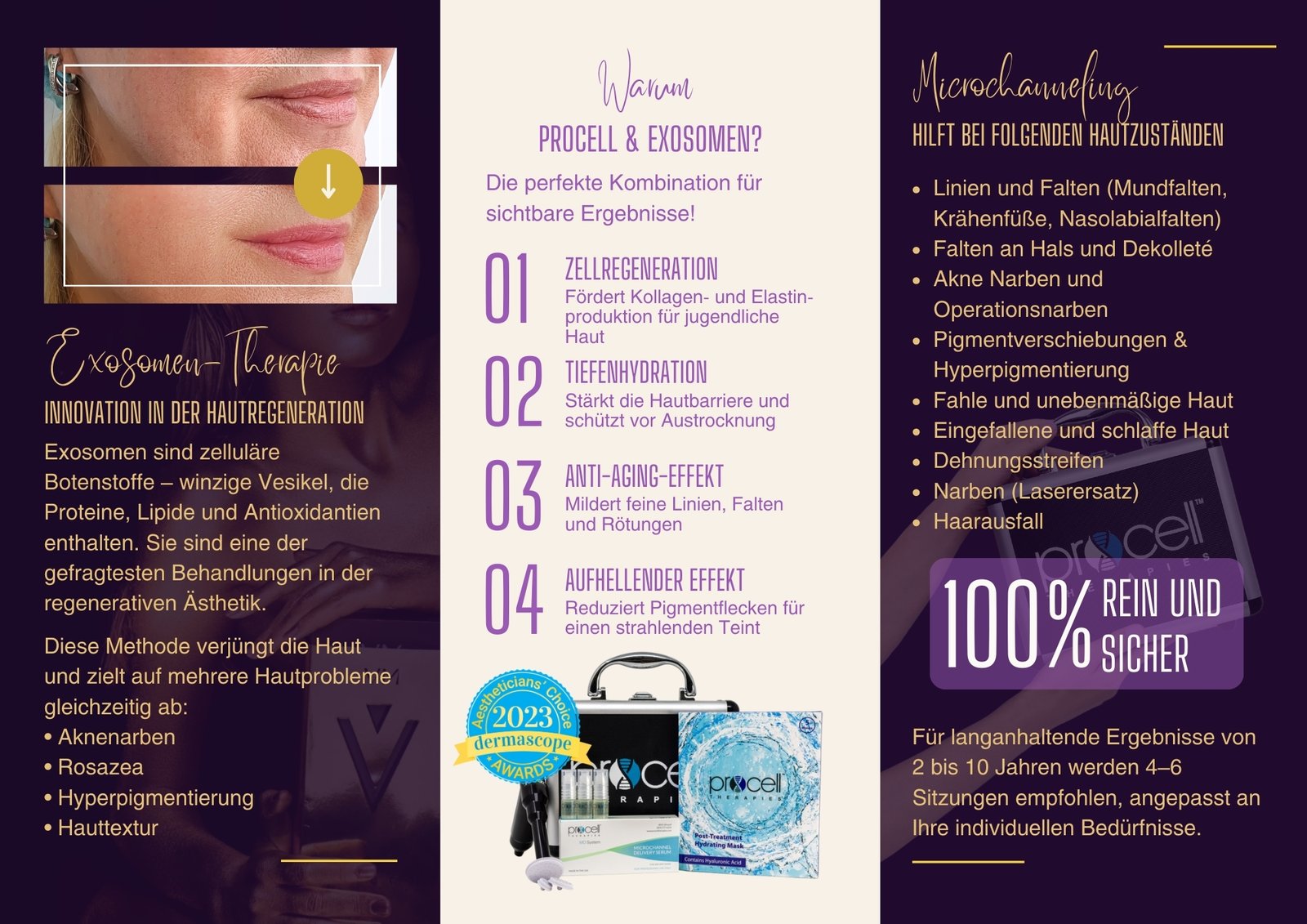 Inside spread of the purple Nativis brochure with numbered benefits of Procell and exosome therapy